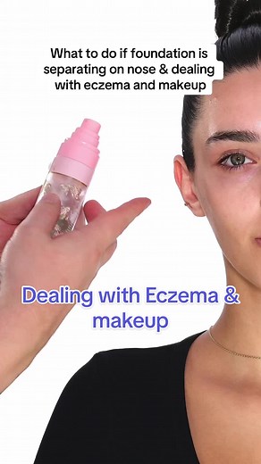 How to Prevent Foundation Separation on Nose & Deal with Eczema | Makeup Tips