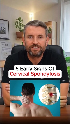 5 Early Signs of Cervical Spondylosis You Should Know