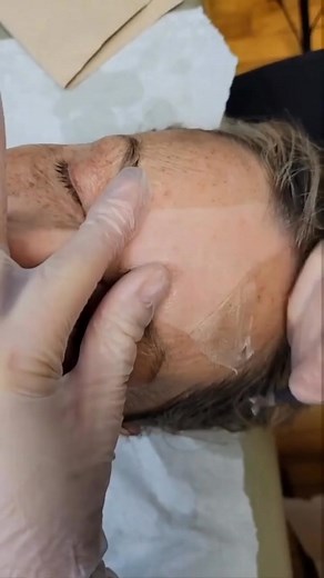 Understanding Laser Skin Treatments: Cost, Benefits, and Options | Professional Service