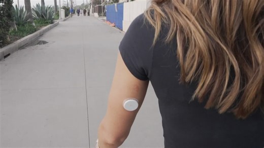 Continuous blood-sugar monitors now available over the counter