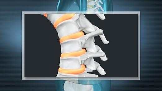 DDS 300 [Decompression Belt] - How it Works