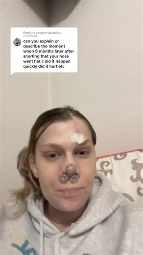 820K views · 4.5K reactions | Replying to @recoverybarbie #fckaddicition #recovery #dontdodrugs #wedorecover #recoveryispossible #recoveroutloud #addictionawareness #addictionisadisease #recoverytok #flappy #foreheadflap #surgery | Addictionawareness | Facebook