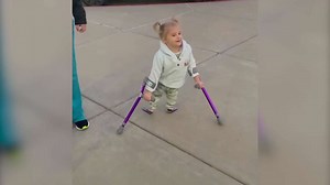 Five-year-old girl born with "mermaid syndrome" has taken her first steps after surgery