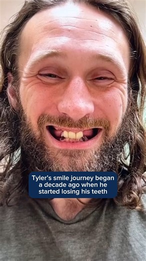 Tyler's journey to a new smile wasn't just about dental work—it was a story of love, support, and resilience. Moments like these remind us of the profound impact a smile can have on our lives. We're honored to be a part of Tyler's transformation and grateful for the opportunity to witness such heartwarming moments. What is something that makes you smile? Comment below. #AspenDental #InYourCorner #NationalSmileMonth #patientcare #smile #dentures | Aspen Dental