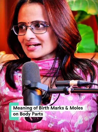 Understanding Birth Marks and Moles on Your Body