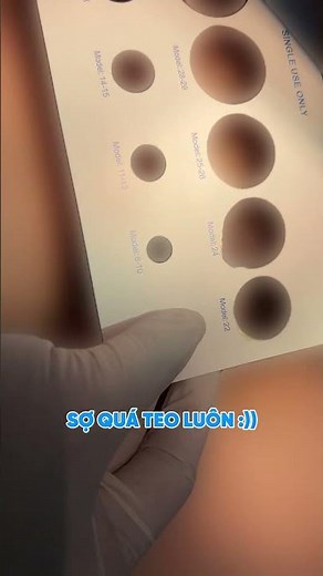 Thủ tục đo size trước khi tiểu phẫu Cắt Bao Quy Đầu