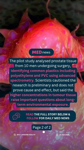 🔬 Microplastics Found in 90% of Prostate Cancer Tumors #cancer #healthnews #microplastics