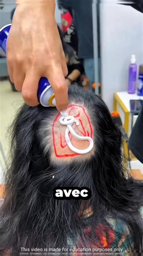 96K views · 308 reactions | Une mini-perruque qui change sa vie  | Hugo Anecdote | Facebook