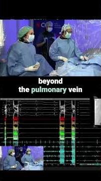 PVI first or add posterior wall ablation?