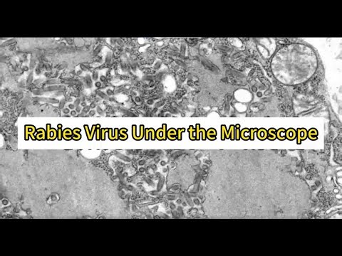 Rabies Virus Under The Microscope