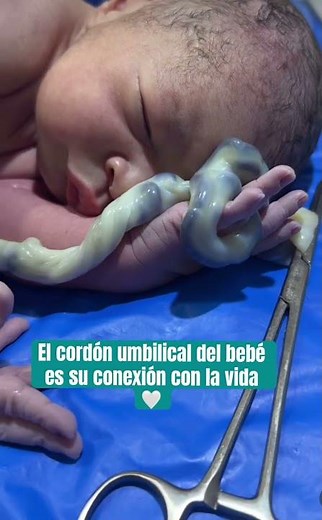 El cordón umbilical es algo increíble que vale la pena observar y detallar ❤️ Like si es interesante