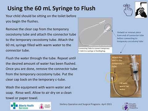 Your Child's CHAIT Cecostomy Tube