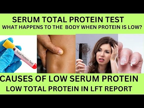 Total protein blood test.TP(Total protein in liver function report).Causes of low total protein