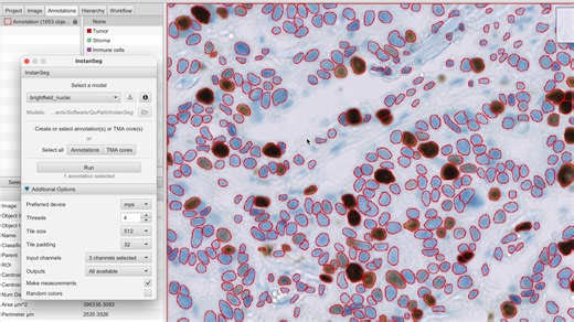 开源软件第34讲——QuPath的细胞识别，分类，以及InstanSeg