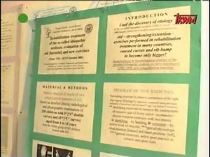 Skoliozy idiopatyczne (4/4)