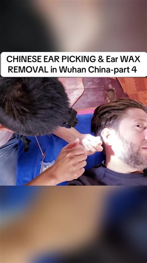 CHINESE EAR PICKING & Ear WAX REMOVAL in Wuhan China-part 4 #fyp #earwax #removalvideo #earpicking #wuhan