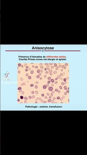 les maladies des globules rouges