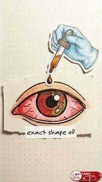 Why A Painful Red Eye Destroys Vision | Ophthalmology