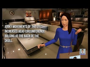 Dandy walker Syndrome