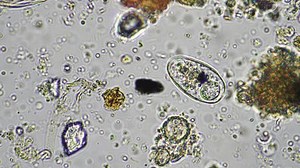 Soil Microorganisms Compost Sample Including Bacteria Stock Footage Video (100% Royalty-free) 3475107283 | Shutterstock