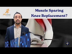 Jiffy Knee Replacement Surgery Explained | Muscle-Sparing Knee Replacement (Faster Recovery!)
