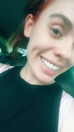 Finally my ileostomy got reversed!! I’m so happy!!!🙌❤️ #crohnsdisease #ibd #stoma #ileostomy #crohnicillness #crohnsawareness #ostomybag #reversal #surgery #completed