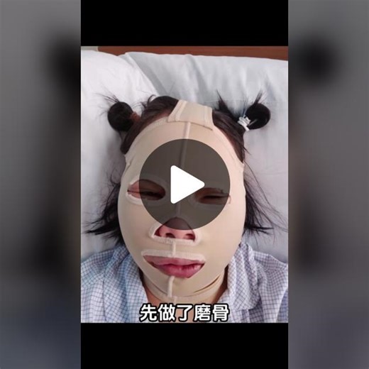 科技脸也挺好！让我活成我想要的样子，非常有满足感，谢谢付出的一切！#整形手术 #变美逆袭 #整形 #变美改造 #整形外科 #变美就是这么简单... | Mask Girl