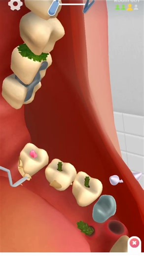ASMR teeth cleaning animation #asmr #teethcleaning