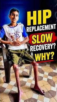 The Cost of DELAYED Surgery