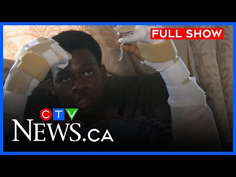 Sword attack victim speaks out in Brandon | CTV Morning Live Winnipeg for June 19, 2025