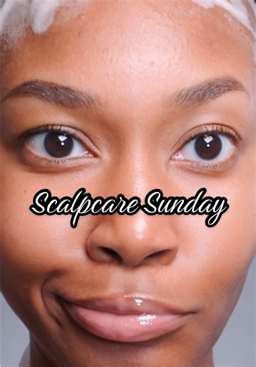 60% chance of rain but 100% chance of shineeee 😛😂 #scalpcaresunday #scalpcare #baldies
