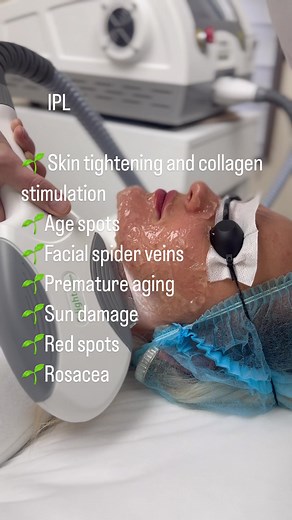 Revitalize Your Skin with Intense Pulsed Light (IPL) Treatment