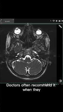 CISS Sequence in MRI | Indications & Anatomy Visualization