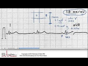 ECG Interpretation, Size And Timing Scale, Part 6-2 • Video • MEDtube.net