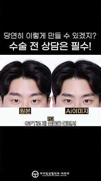 Why do my eyes look different than I imagined..? #DoubleEyelid #MensDoubleEyelid #EyeSurgery