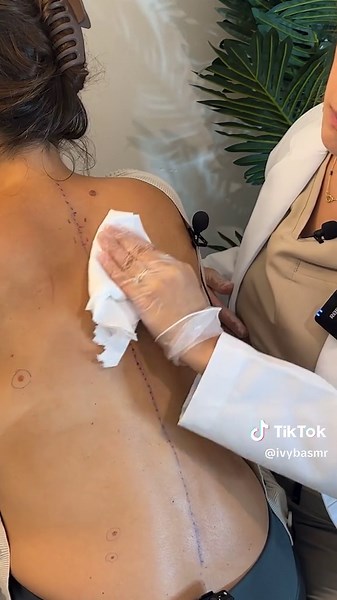 ASMR Back Exam: Skin, Spine Assessment, Tracing, Massage | Skin Pulling Soft Spoken Roleplay with @madpasmr1 #asmrmedicalroleplay #asmrbackexam #asmrrelaxingsounds #asmrtriggers #asmrtingles #soundon #useheadphones #ivybasmr