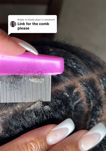 Effective Dandruff Comb for Flake-Free Scalp