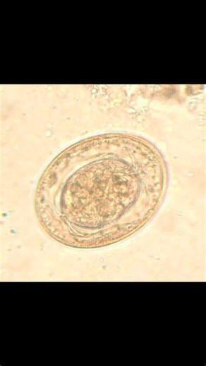 stool Examination. identify the parasit ova. #stoolexamintion #parasitologya #microbiologylab #medicaltiktok #Microscopy