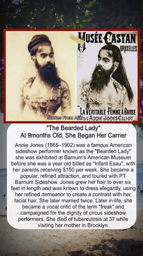 Annie Jones "The Bearded Lady" #history #story #facts