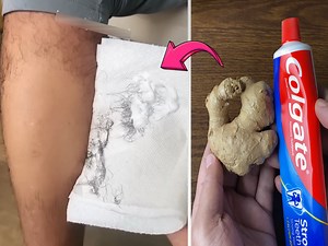 12K views · 33 reactions | DIY Hair Removal Cream| Unwanted Facial Hair Removal | Simple Home Remedies | Facebook