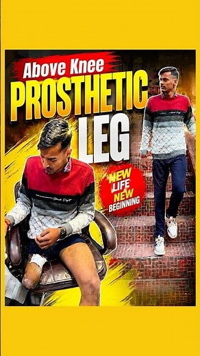 Above Knee Prosthetic Leg | Advanced Artificial Limb for Walking | #naklitang #ossur #prostheticleg