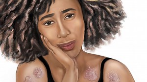 Medical student's illustrations featuring Black people, skin tones spark national project