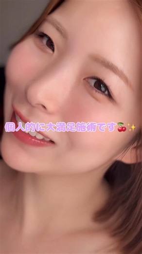 さかす | 30代美容記録帳 | NEWSTAR CLINIC @newstarclinicjp 涙袋フィラーをしてもらった🥨🫧 フィラーの種類はレスチレン💉 1ccずつお願いできるけど実際に入れたのは両目で0.1ccくらい？かなり少ない量です！ ナチュラルだけど変化がでるようにお願いしました🍐... | Instagram