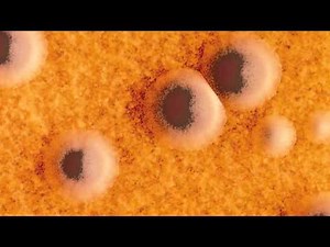 Corynebacterium diphtheria and Diphtheria