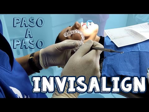 Ortodoncia invisible, invisalign│Paso a Paso