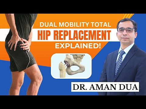 Dual Mobility Total Hip Replacement: Benefits and Procedure Explained | Dr Aman Dua #hipreplacement