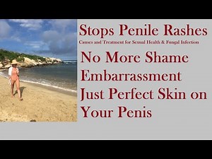 Stops Penile Rashes - Causes and Treatment for Sexual Health & Fungal Infection