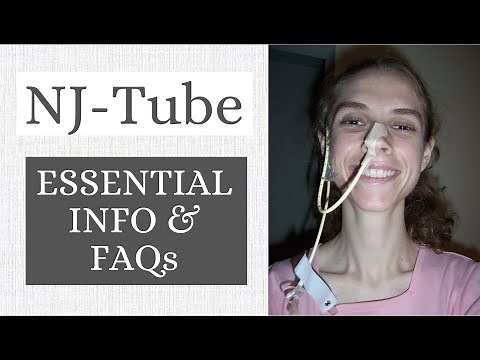 Nasojejunal (NJ) Feeding Tube. Essential Info & Frequently Asked Questions. Life with a Vent
