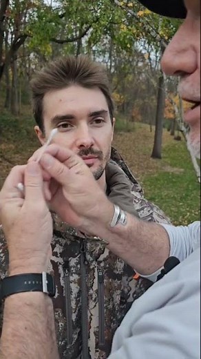 How to Flip an Eyelid to find a foreign body. #eyeinjury #foreignbodyeye #outdooreyecare #lidflip