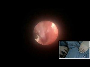 Copy of Laser repair of ectopic ureter in a dog